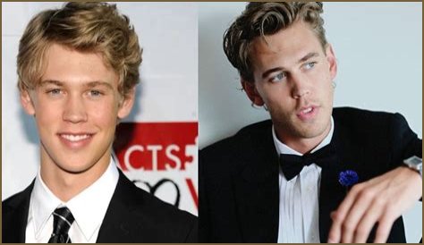 Did The Elvis Star Have Jawline Reconstruction Surgery and Nose Job? Fans Seek Before and After Pictures!